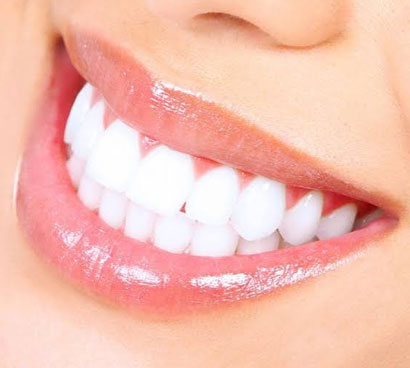 Teeth Whitening