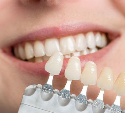 Porcelain Veneers