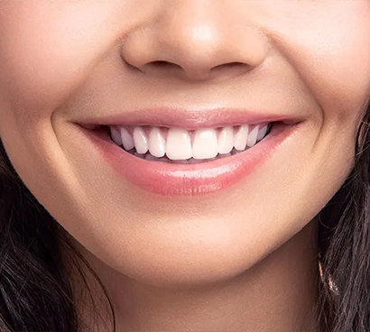 Beautiful Smile