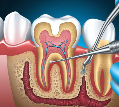 Minimal Removal, Maximum Preservation
