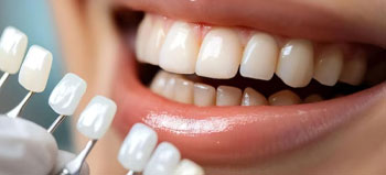 Cosmetic Dentistry